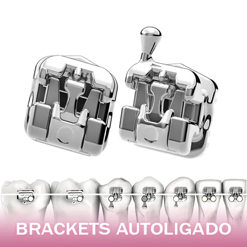 Ortodoncista con Brackets de Autoligado Cl?nica Martinelli Garcia